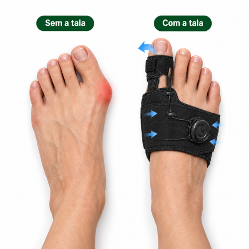 Sem a tala e com a tala Sossego: posição do dedo grande