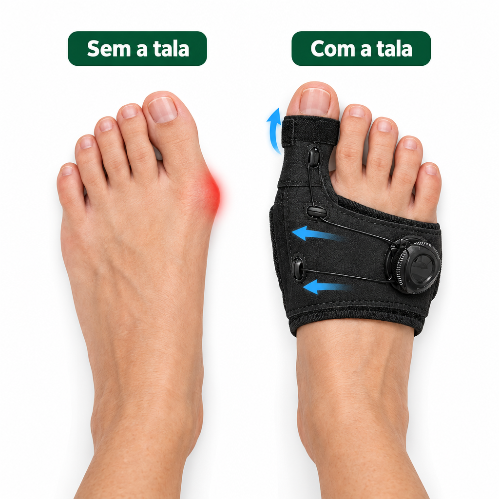 Comparação sem e com a tala Sossego